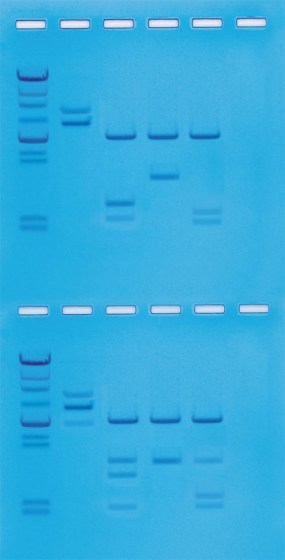 clivage-adn-lambda-enzymes